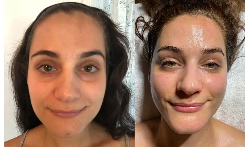 facial West Hollywood